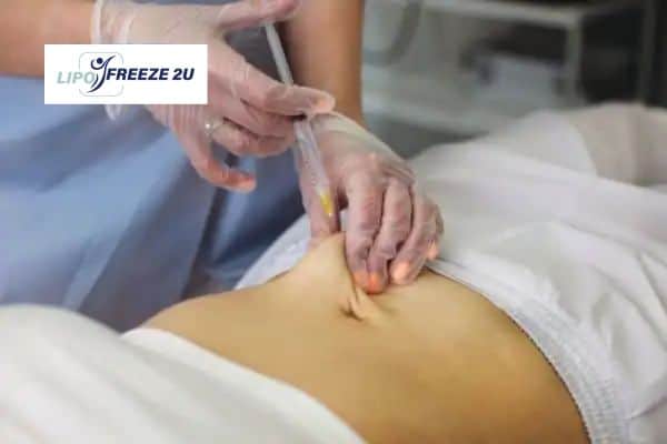 How Does Aqualyx Fat Dissolving Injection Work to Break Down Fat Cheltenham?