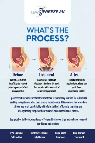 Diagram of how incontinence treatment Cheltenham works.