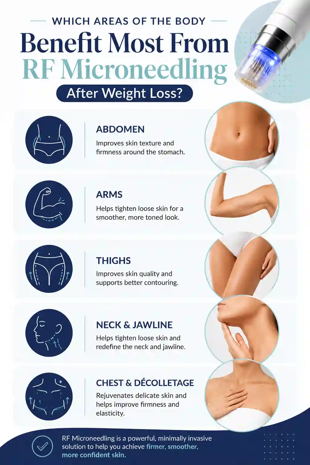 Which Areas of the Body Benefit Most From RF Microneedling After Weight Loss Cheltenham